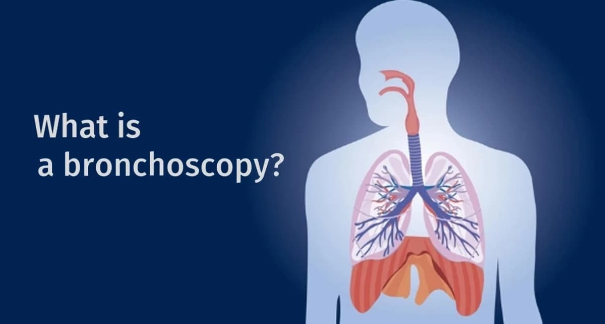 What Is Bronchoscopy? Procedure, Uses, Risks and Recovery