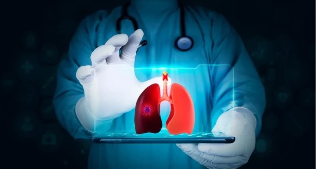 EBUS Test: Why Is Endobronchial Ultrasound Done?