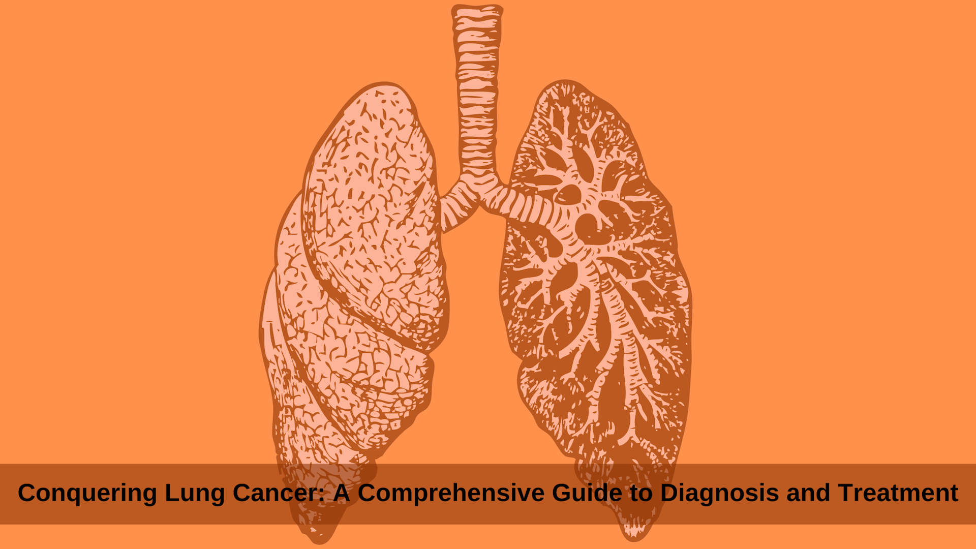 Conquering Lung Cancer: A Comprehensive Guide to Diagnosis and Treatment